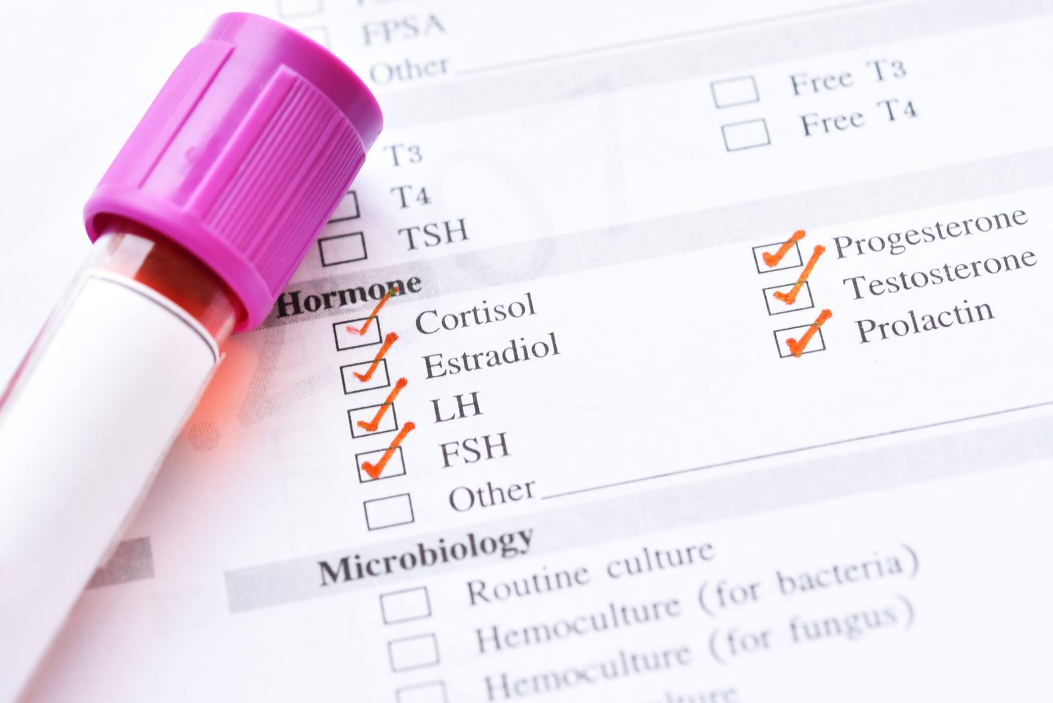 hormone testing Natural Hormone Balance