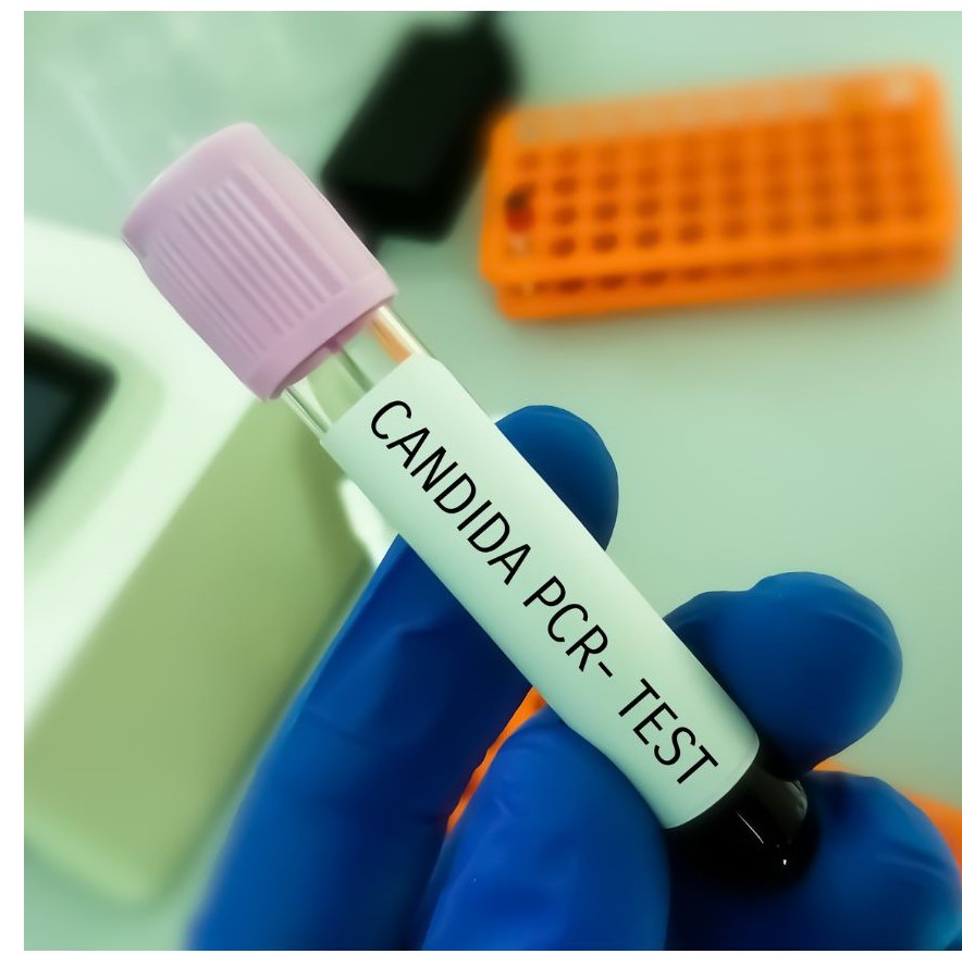 A gloved hand holds a test tube labeled