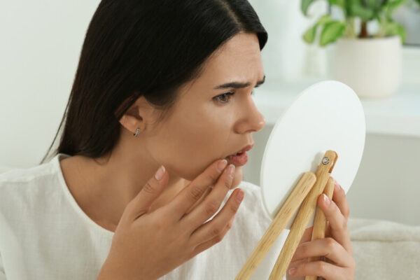 high dhea sulfate in females