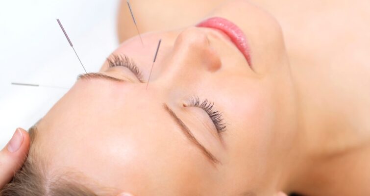 Facial Rejuvenation Through Cosmetic Acupuncture