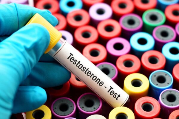 Eat Raw Onions to Boost Testosterone? What the Research Says