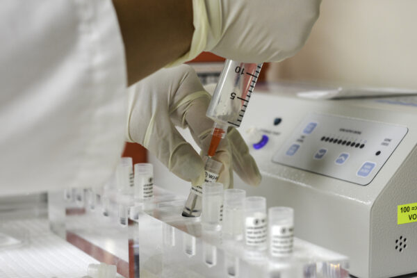 stem cell therapy for autoimmune disease
