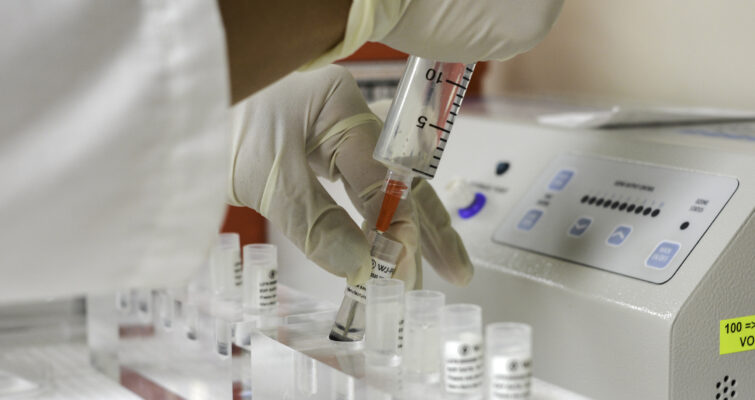 stem cell therapy for autoimmune disease