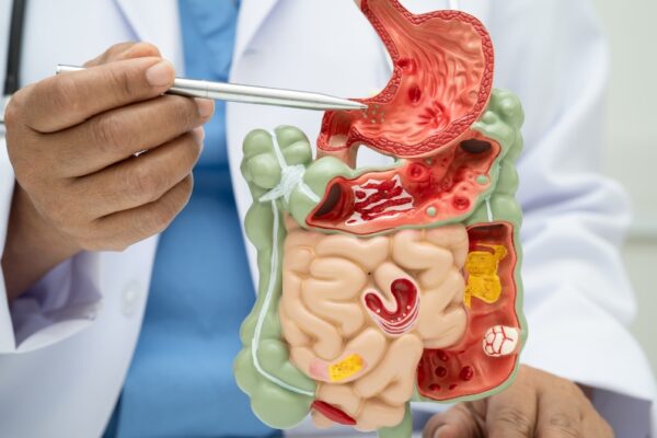 TMG or Betaine HCl? Comparing Their Roles in Methylation and Digestion