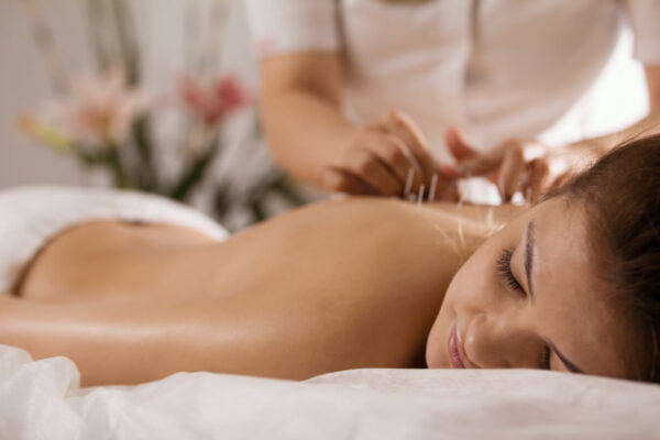 Acupuncture