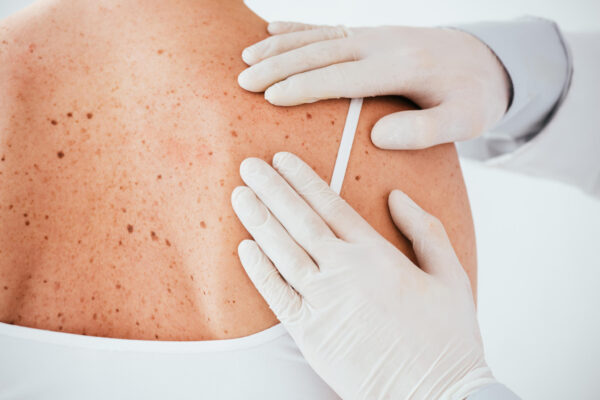 A woman receives a skin examination from a doctor in a clinical setting.