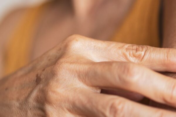 A woman applies a hormone replacement therapy patch to her arm, highlighting options available in Atlanta.