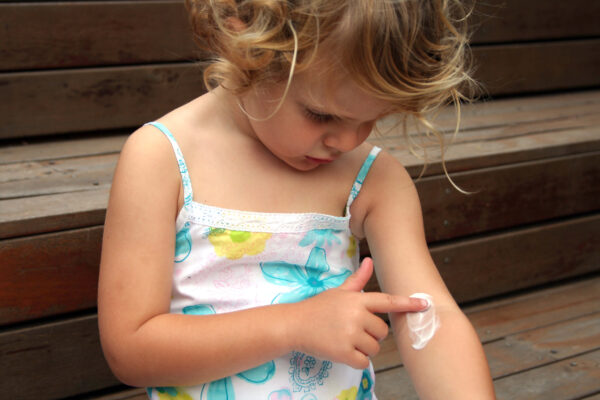 children eczema