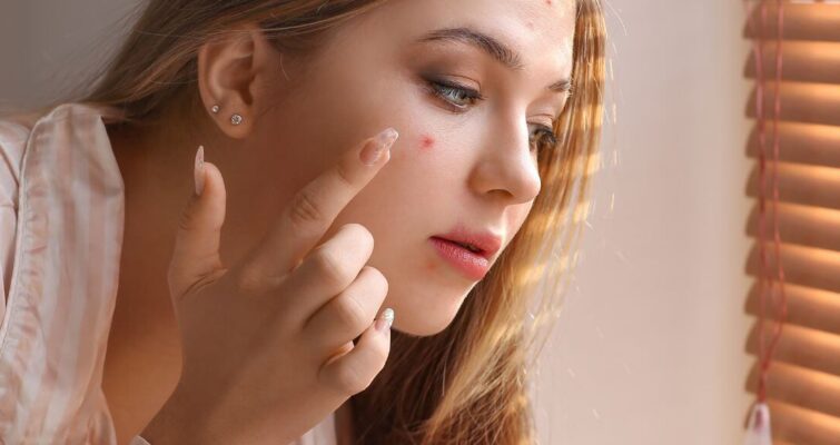 A woman examines her face in front of a window, reflecting on the effects of Chinese medicine for acne.
