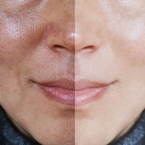 Integrative Facials
