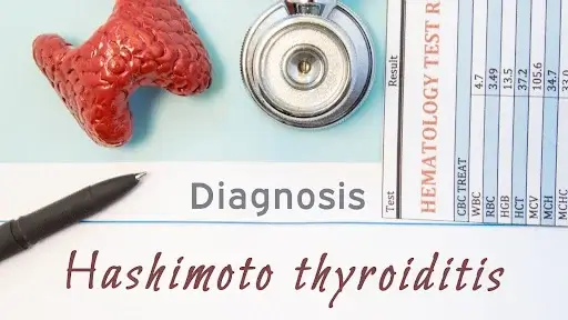 Hasshmoto thyroiditis affects thyroid hormone production, impacting women's fertility and overall health.