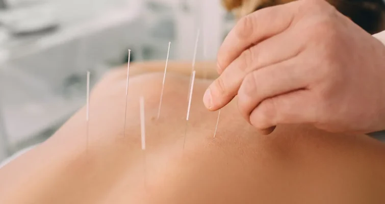 acupuncture effect on infertility with functional medicine