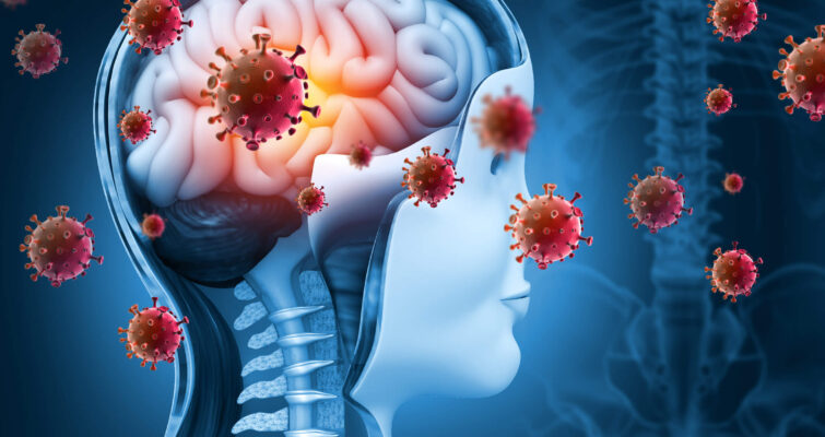 Long-Covid-19 and POTS