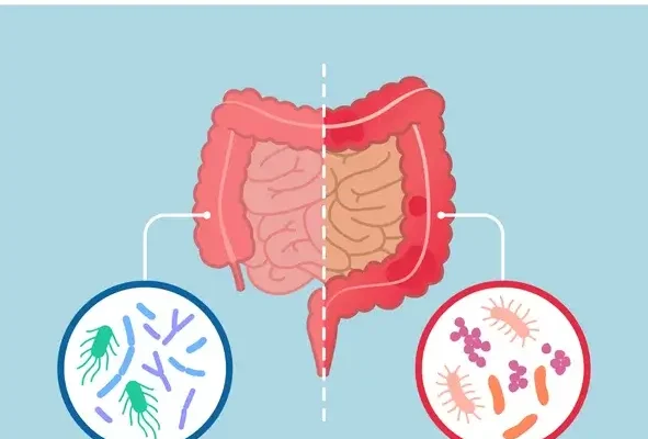 Good and bad gut bacteria