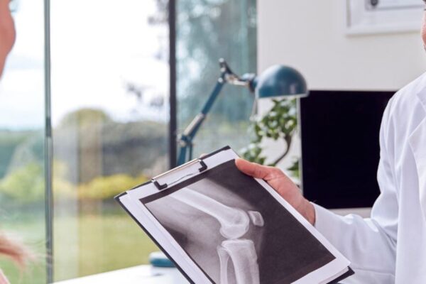 A man holds an X-ray image of a woman, illustrating the 4 stages of osteoporosis.