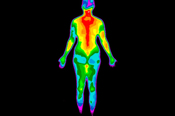 back of Scan results from a full-body thermogram