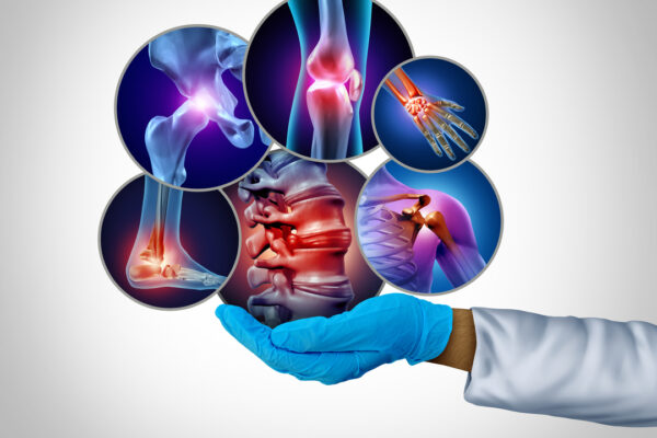 A gloved hand holds a collection of circular images depicting various joint and bone conditions, including a knee, wrist, and spine, rendered in blue and pink hues against a gradient background.