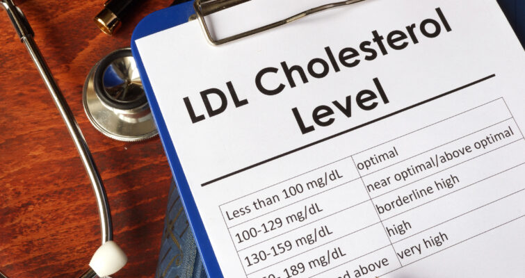 ldl cholesterol test results on a clipboard in a holistic doctors office