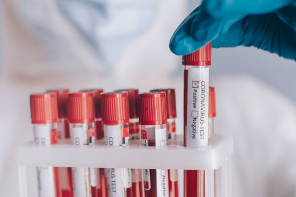 tubes of blood from functional lab tests