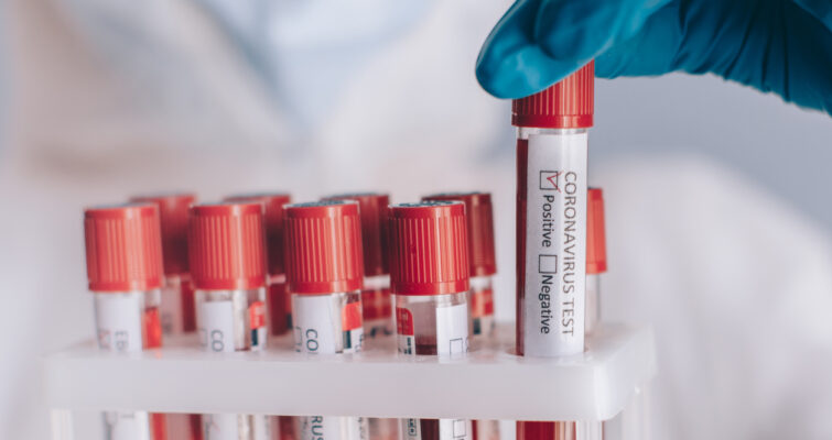 tubes of blood from functional lab tests